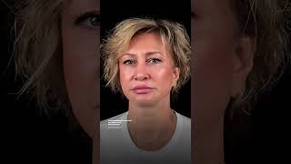 Омолаживающий комплекс для лица - яркий результат через 8 месяцев