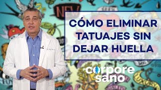 ¿Existe alguna técnica para eliminar tatuajes sin dejar huella? screenshot 1