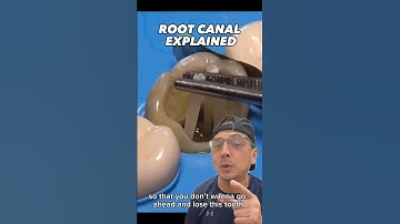 Saving a Tooth with a Root Canal and a Dental Crown | In Office to Hands On Dental Training #shorts