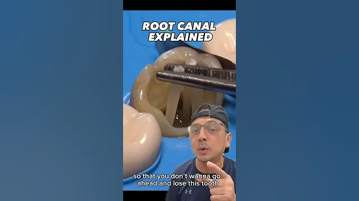 Saving a Tooth with a Root Canal and a Dental Crown | In Office to Hands On Dental Training #shorts