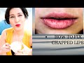 How to Fix Chapped Lips | Chapped Lips Remedy