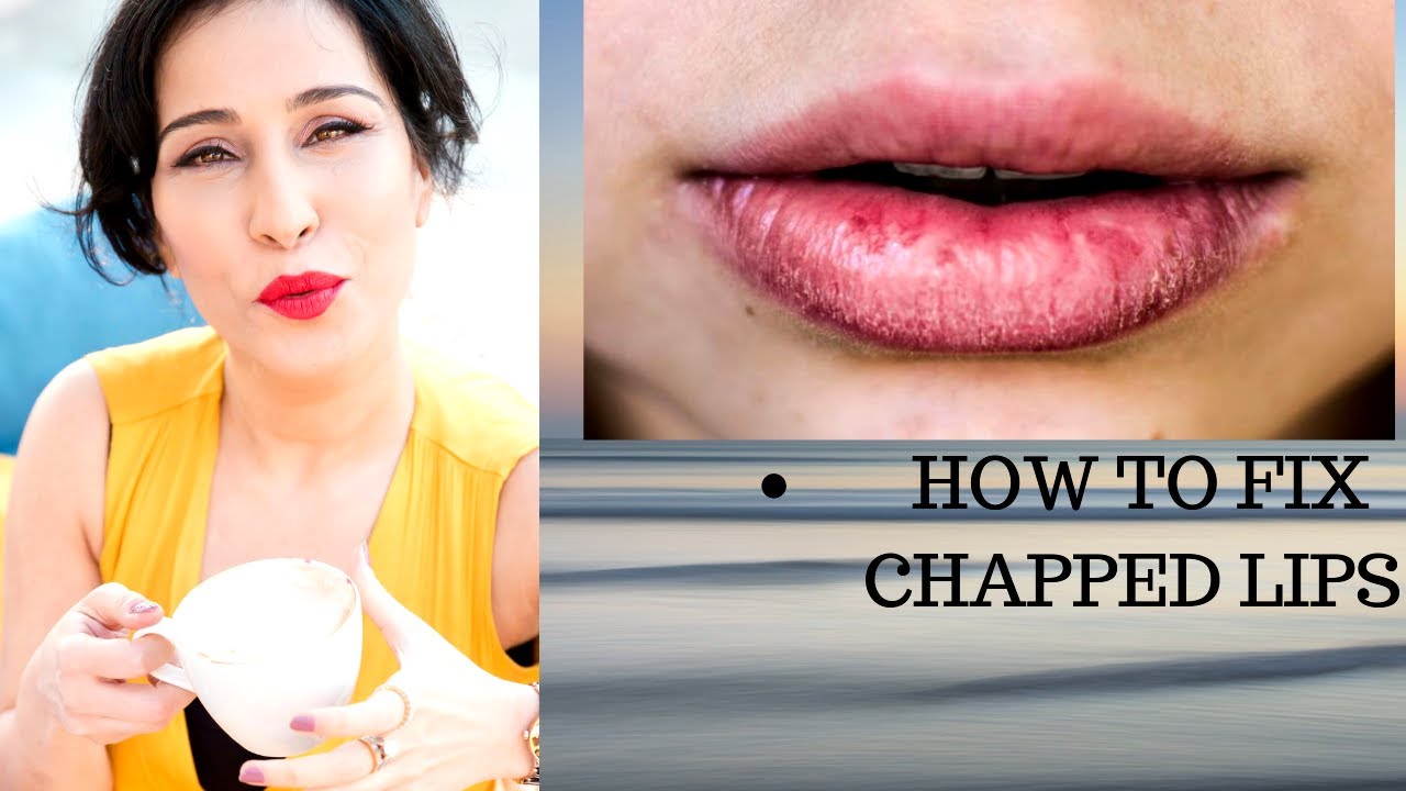 How to Fix Chapped Lips | Chapped Lips Remedy - YouTube