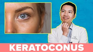 Will I Go Blind If I Have Keratoconus?