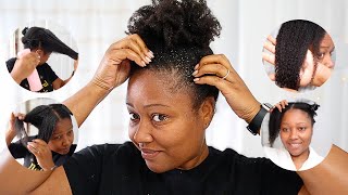 The PERFECT Wash Day Routine for DRY FLAKY Scalp! | SUPER DETAILED TUTORIAL!!