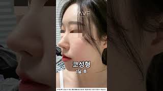 4번째 코성형 후 염증증상과 코쳐짐으로 5번째 코성형도전기!