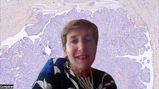 2022 WHO classification: updates in bladder cancer