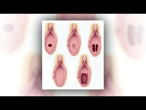 Ella Estrecho Su Vagina Naturalmente en Pocos Dias. ¡Aprende Hacerlo! - Vida Sana