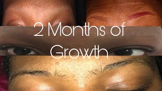Celebrity Shaved My Eyebrows Off(2 Months of Growth) Profile