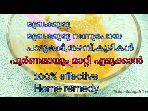 How to remove pimples, acne, scars ||Effective Home remedy||Remove dark spots||MALAYALAM