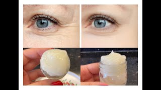 Uyumadan Önce Sürdü Kirişikliklar Kayboldu-Göz Çevresi̇ndeki̇ Kirişiklik Nasil Açilir