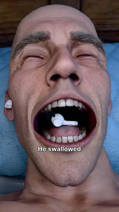 AirPod Swallowed While Sleeping😮
