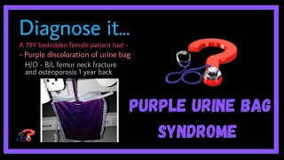 Purple colored urine, Purple urine bag syndrome