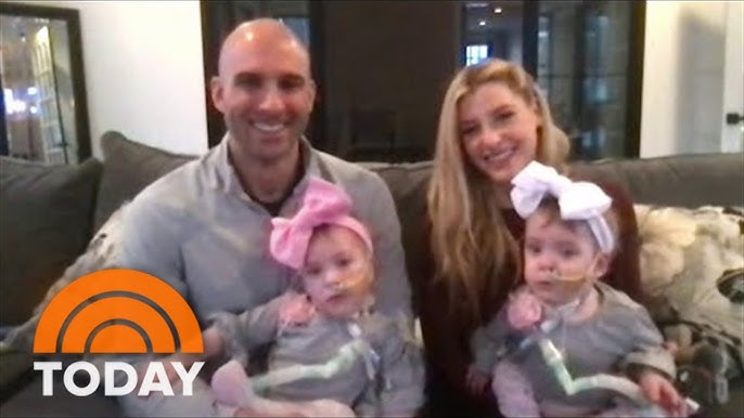 Formerly Conjoined Twins Thrive Following Separation Surgery - YouTube
