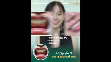 THẨM MỸ RĂNG SỨ HT SMILE – GIẢI PHÁP CHO NỤ CƯỜI TỎA SÁNG #shorts