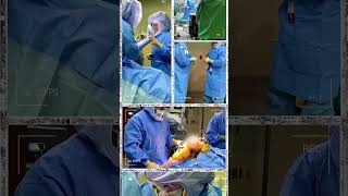 Robotic Operating Room Action: Total Knee Replacement shorts