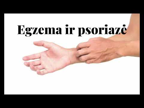 Video: 3 būdai, kaip dėvėti makiažą sergant egzema