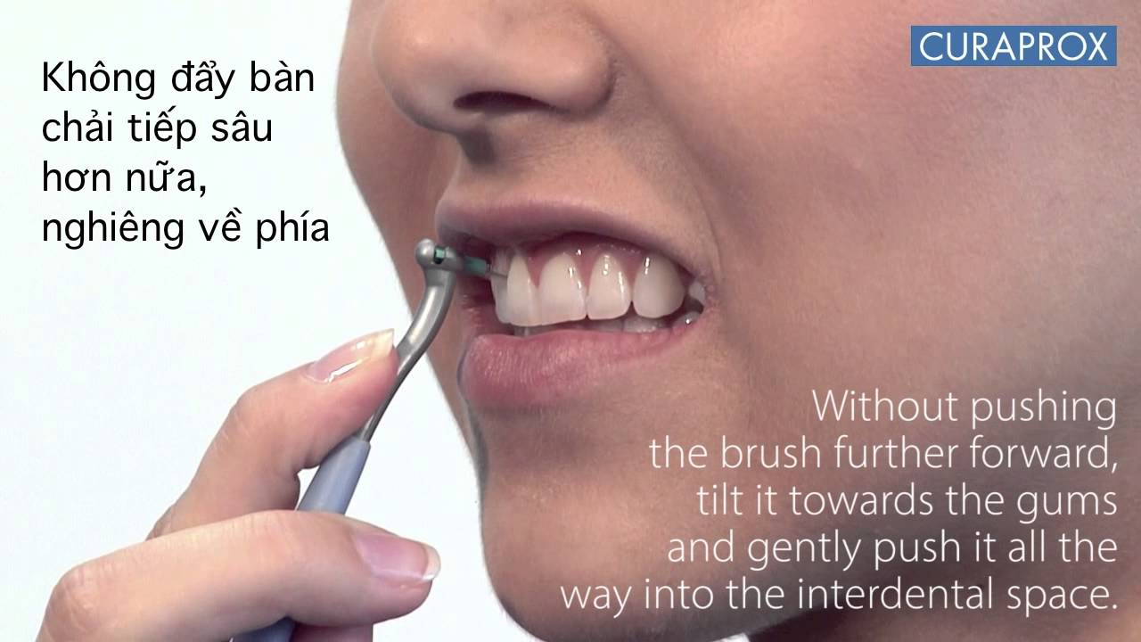 Hướng dẫn dùng bàn chải kẽ răng tránh viêm nướu - YouTube