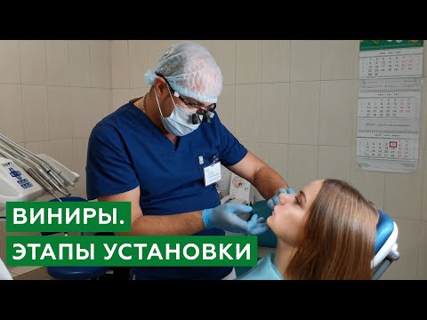 Виниры. Этапы установки виниров