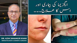 Skin Allergy, Eczema Treatment in Lahore, Islamabad, Karachi, Pakistan