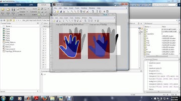 A Topology Preserving Level Set Method for Geometric Deformable Models