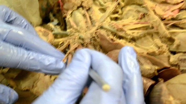 Canaday Amy 2b Cat Veins