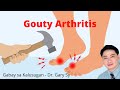 Gouty Arthritis - Dr. Gary Sy