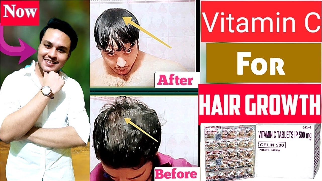 Vitamin C for hair growth vitamin C for hair loss vitamin C for