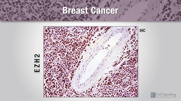 Epigenetics Drivers of Breast Cancer