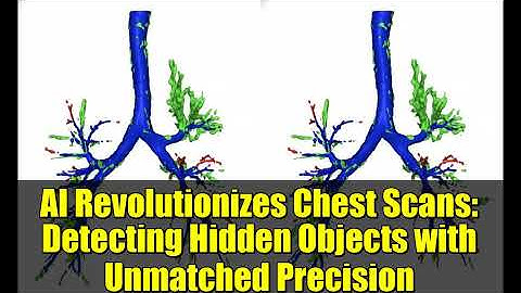 AI Revolutionizes Chest Scans: Detecting Hidden Objects with Unmatched Precision