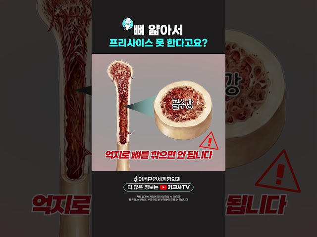 "의사마다 말이 달라요" 키수술 가능 여부, 왜 다를까? #이동훈연세정형외과