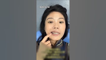 Nhổ răng có ảnh hưởng đến thần kinh không? #nhatkyniengrang  #nhakhoa  #viral  #shorts