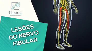 Onde fica o nervo peroneal?