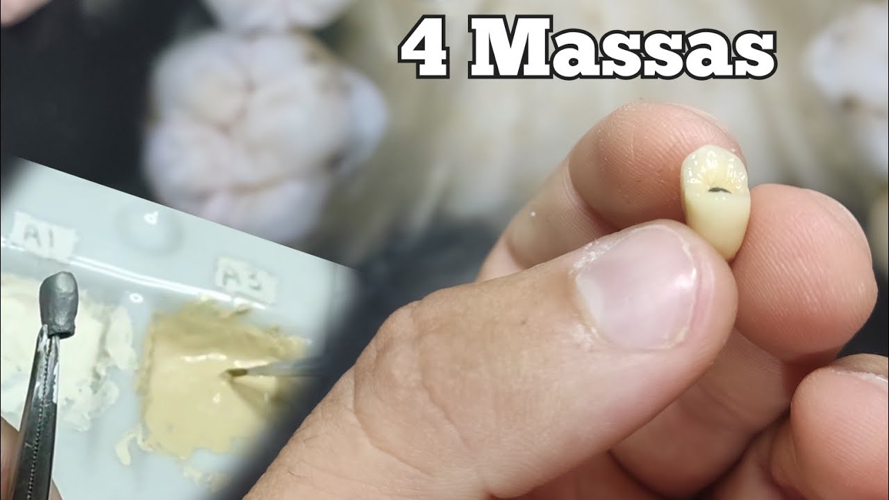 APLICAÇÃO DE CERÂMICA NORITAKE EX3- Passo a Passo