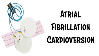 Dr. Bruce Janiak's Cardioversion from Atrial Fibrillation