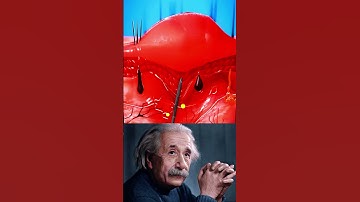 How Splinters Get Unstuck #trending #shorts #ai