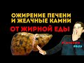 Ел МНОГО ЖИРОВ 2 года: камни в желчном пузыре, ожирение печени. Палео карнивор кето диета вред жиров