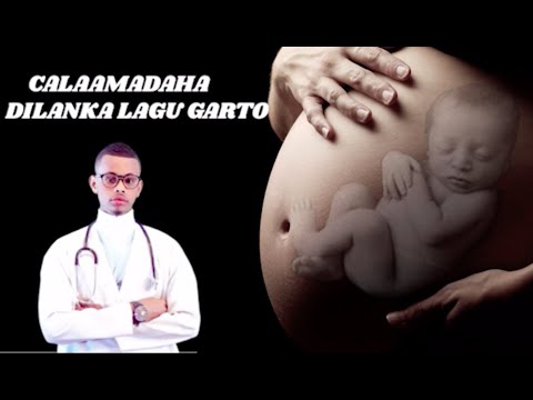 NOOCYADA KALA DUWAN DILANKA ama DHICSKA IYO CALAAMADAHA LAGU GARTO. Dr faris