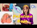 Técnica de Anestesia PALATINA BAJA 🦷 💉