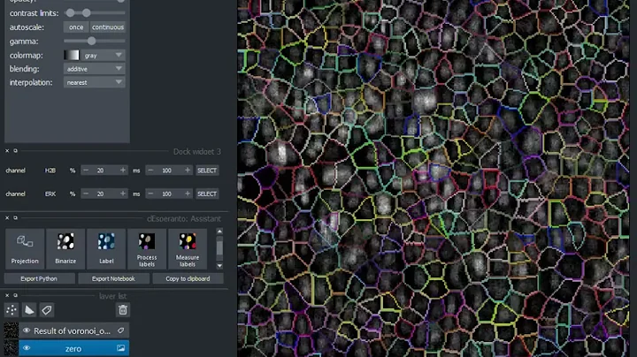 Real-time image segmentation of cells
