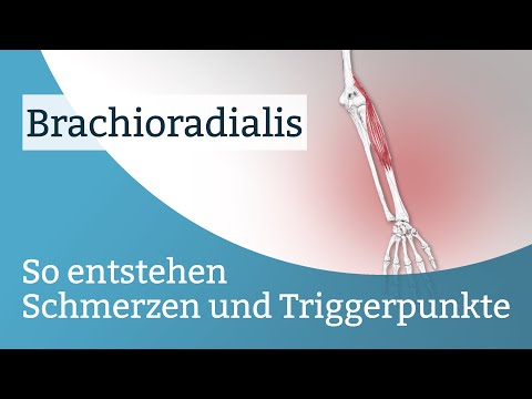 Video: Brachioradialis-Schmerz: Symptome, Ursachen Und Behandlung