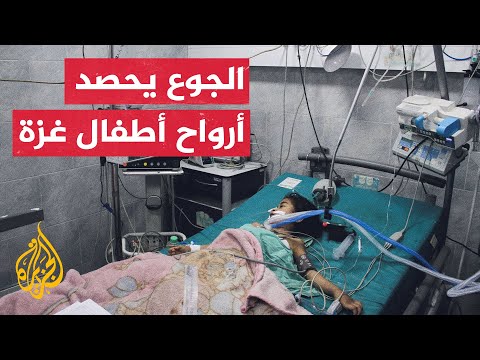 استشهاد الطفل عزام الشاعر بسبب سوء التغذية جراء سياسة التجويع الإسرائيلية
