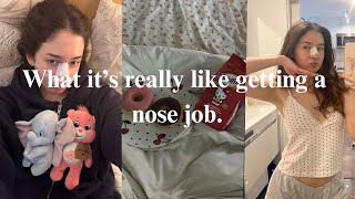 what its really like getting a nose job