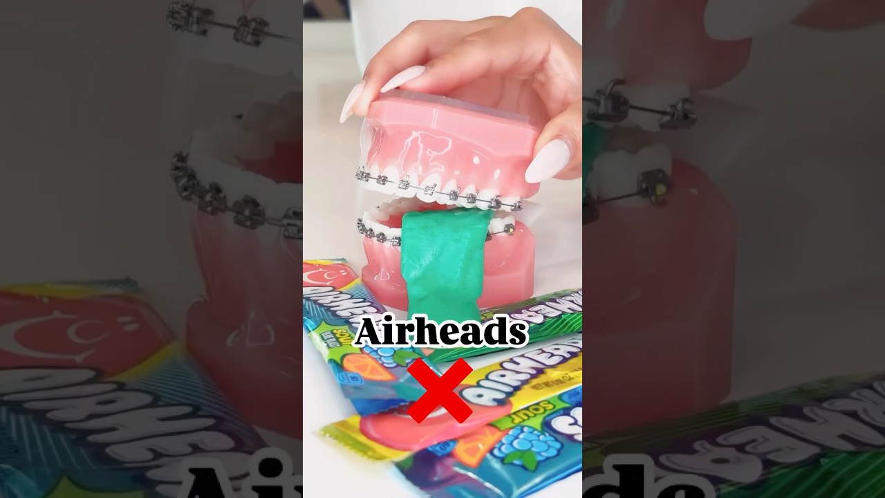 These sweets? “Can’t touch this!” 🍭Keep those braces safe and smiles shining! 