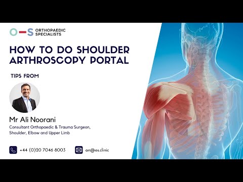 How to Do Shoulder Arthroscopy Portal | Professor Ali Noorani | Orthopaedic Specialists
