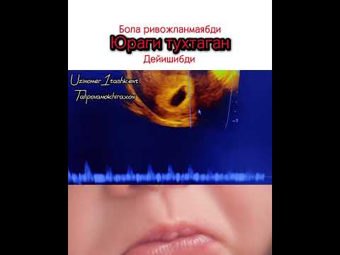 МАЛУМОТ УЧУН ФАКАТ