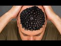 ASMR Medical Scalp Clinic: Sterile Treatment for Deep Sleep & Relaxation