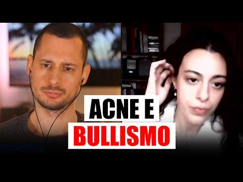 "I was bullied because of my acne": Francesca's story