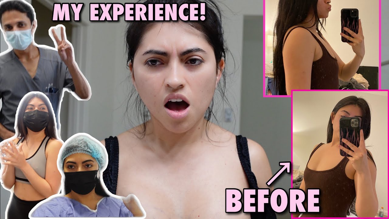 I GOT A BREAST AUGMENTATION! | Yoatzi