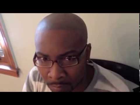 Video thumbnail: African American men | Scalp Pigmentation | Hairsimulation – Update Mr AJ- 3 years