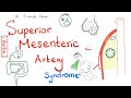 Superior Mesenteric Artery (SMA) Syndrome | Nutcracker Syndrome | Clinically-Oriented Anatomy